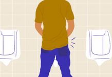 Os sintomas da próstata aumentada podem voltar após a embolização?