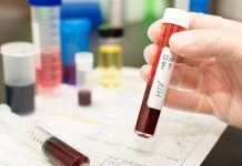 Transmissão do HIV de mãe para filho pode ser evitada