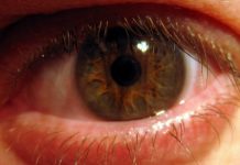 Visita ao oftalmologista pode prevenir câncer nos olhos