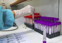 Covid-19: UFRJ desenvolve teste sorológico 20 vezes mais barato