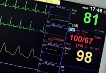 Inteligência artificial auxilia diagnóstico de doenças cardíacas e salva vidas