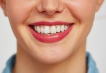 Brancorexia: entenda a obsessão por dentes brancos e os riscos à saúde bucal