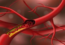 8 de agosto, Dia Mundial de Combate ao Colesterol: Endocrinologista explica a importância de manter a taxa sob controle