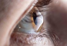 Dia Mundial do Ceratocone: médica alerta que coçar os olhos é a principal causa da doença