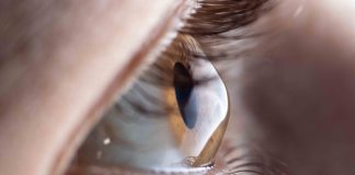 Dia Mundial do Ceratocone: médica alerta que coçar os olhos é a principal causa da doença