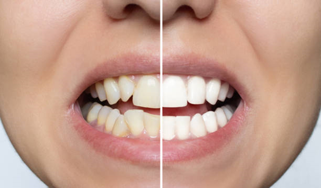 Sorriso desalinhado? Vejas 6 problemas que vão além da saúde bucal