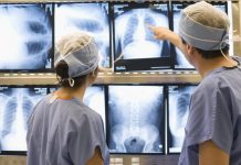 Novo protocolo de tratamento do câncer de pulmão propõe ampliar o acesso à cirurgia torácica assistida por vídeo, para pacientes do SUS