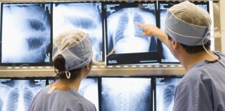 Novo protocolo de tratamento do câncer de pulmão propõe ampliar o acesso à cirurgia torácica assistida por vídeo, para pacientes do SUS