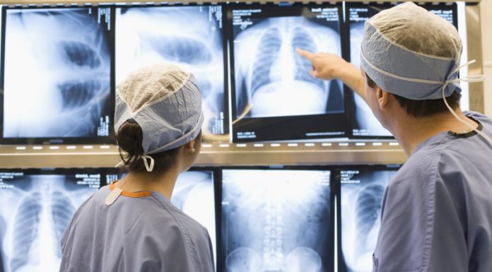 Novo protocolo de tratamento do câncer de pulmão propõe ampliar o acesso à cirurgia torácica assistida por vídeo, para pacientes do SUS